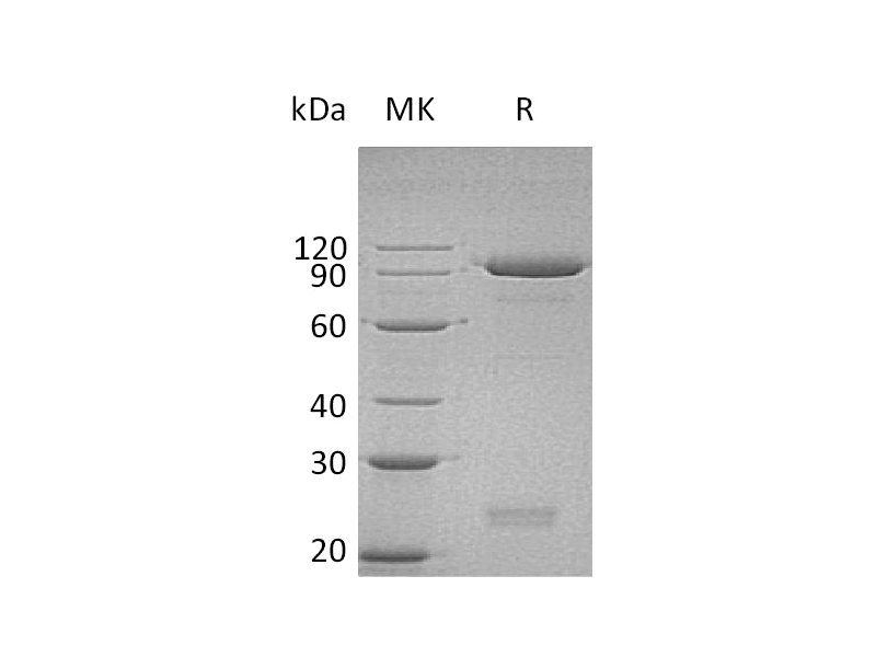 Recombinant Human SEMA3C (C-6His)