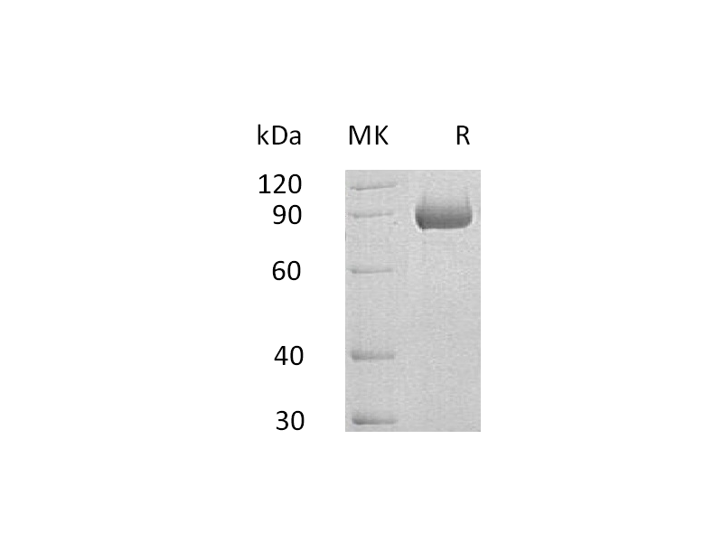 Recombinant Human SEMA4B (C-6His)