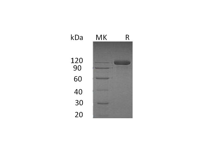 Recombinant Human SEMA4B (C-Fc-6His)