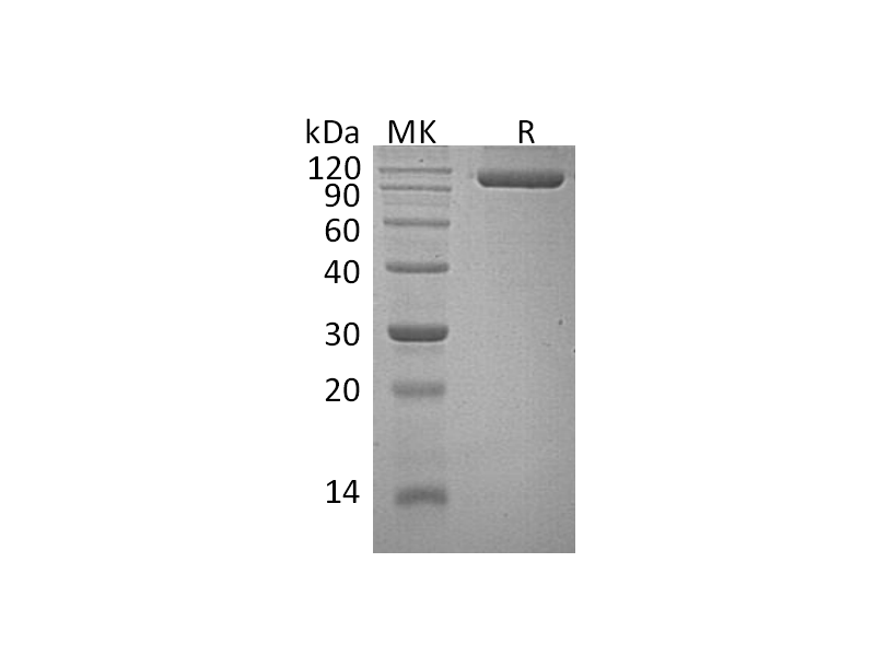 Recombinant Human SEMA4G (C-6His)