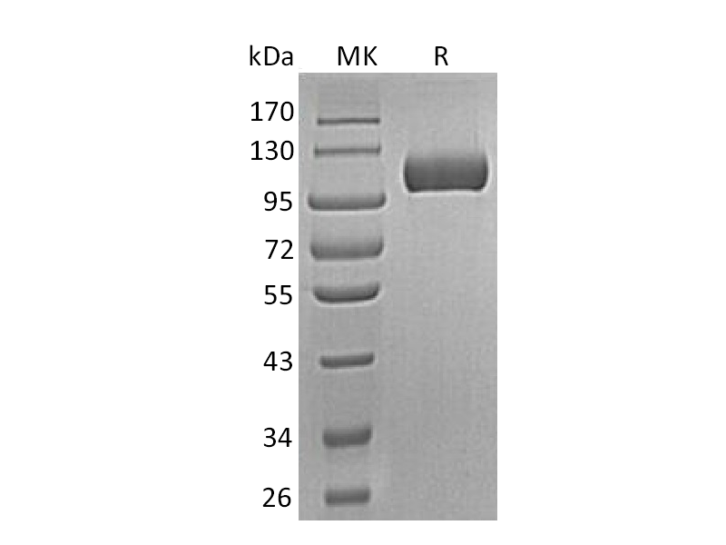Recombinant Human SEMA5A (C-6His)