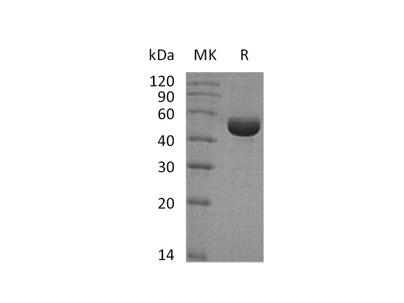 Recombinant Human SHMT1 (C-6His)