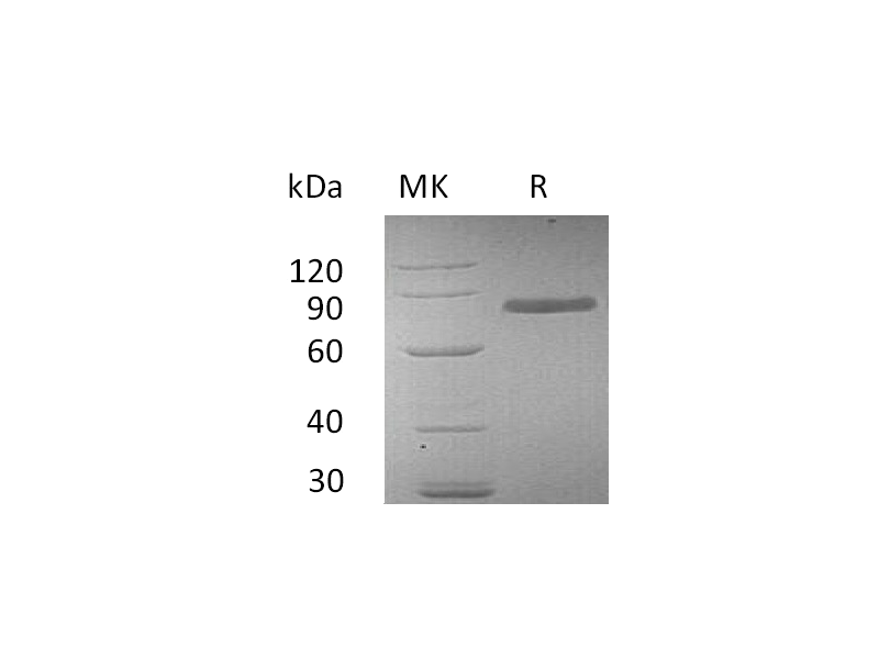 Recombinant Human Transferrin (C-6His)