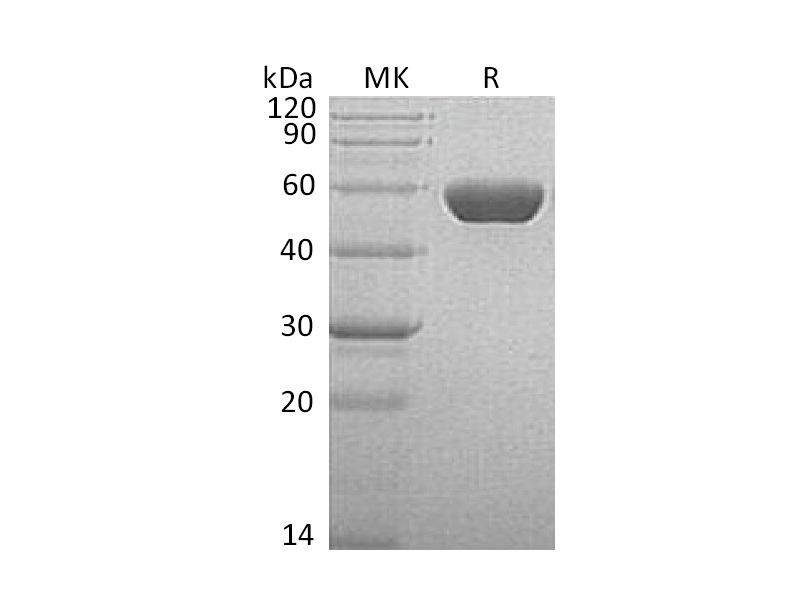 Recombinant Human Serpin A1 (C-6His)