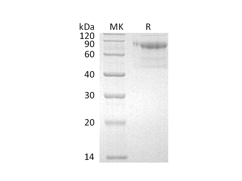 Recombinant Human Serpin A10 (C-6His)