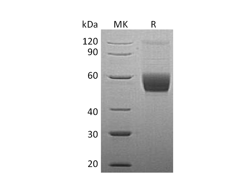 Recombinant Human Serpin A12 (C-10His)