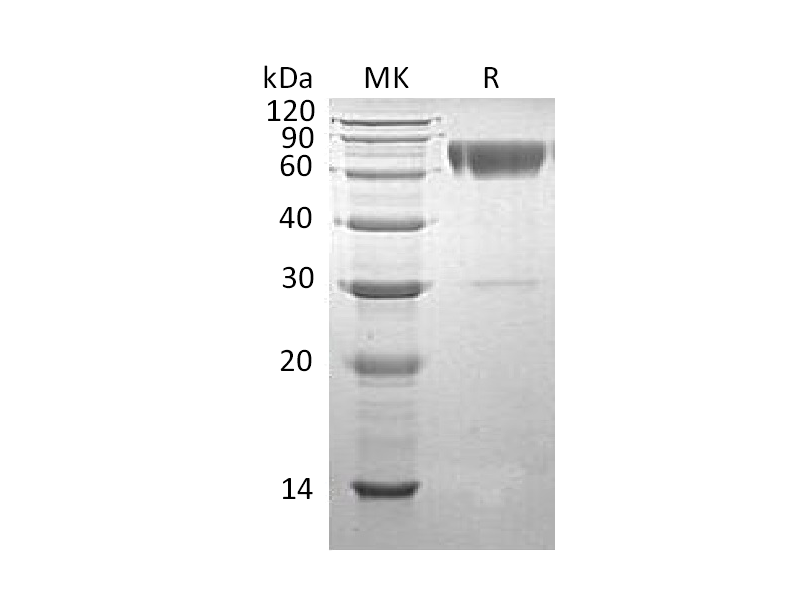 Recombinant Human Serpin A3 (C-6His)