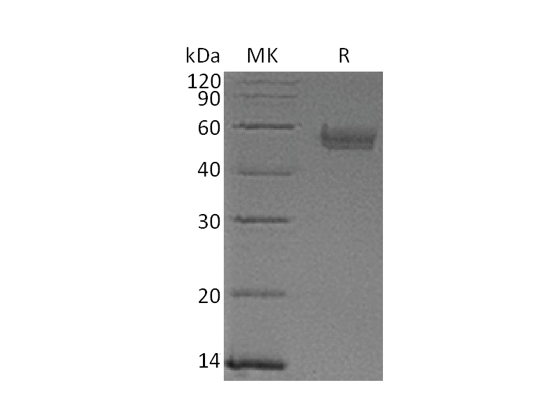 Recombinant Human Serpin A5 (C-6His)