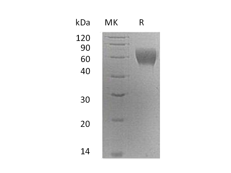 Recombinant Human Serpin A6 (C-6His)