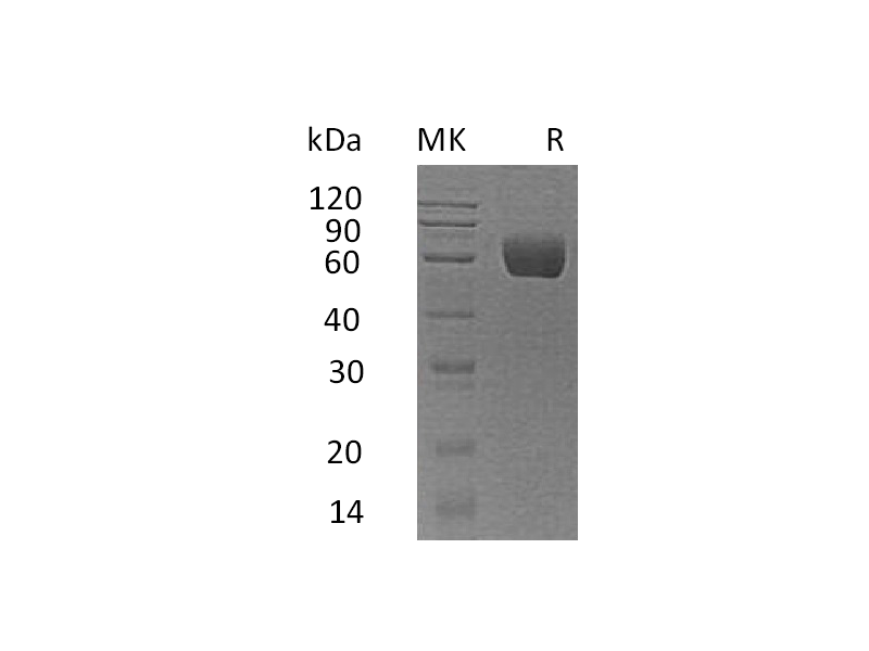 Recombinant Human Serpin A8 (C-6His)