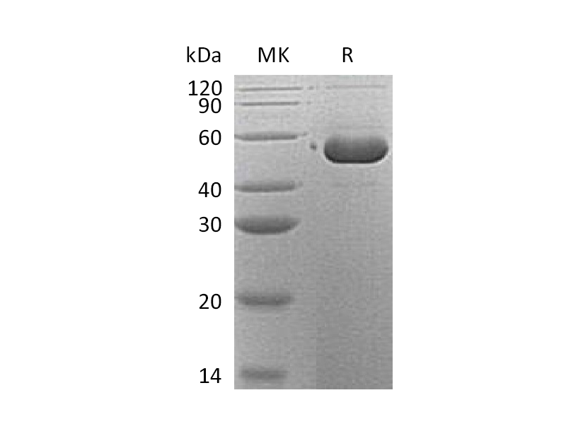 Recombinant Human Serpin B12 (C-6His)