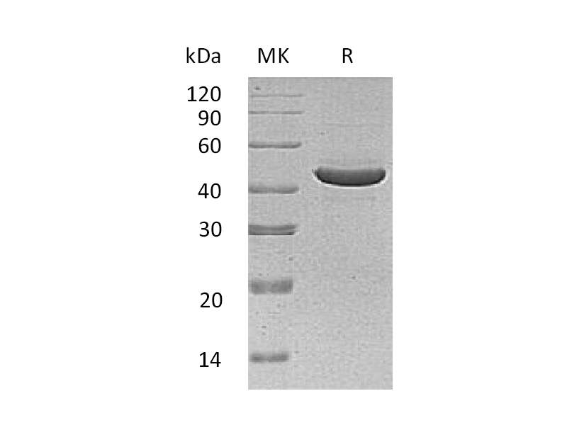 Recombinant Human Serpin B3 (C-6His)
