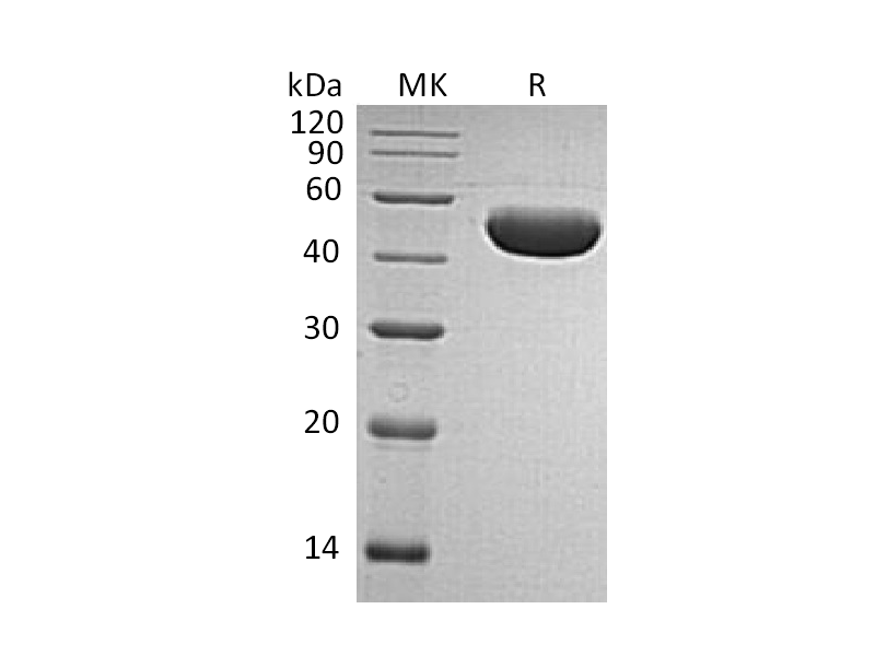 Recombinant Human Serpin E1 (C-6His)
