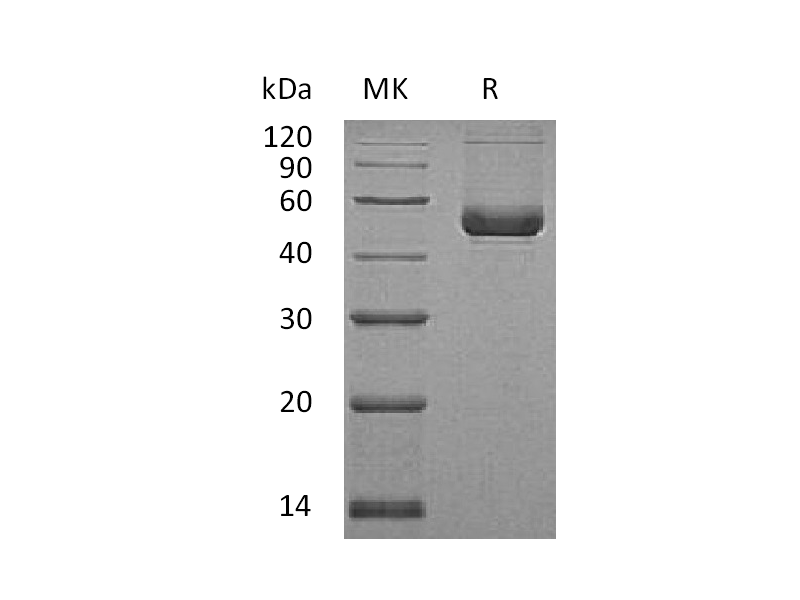 Recombinant Human Serpin E2 (C-6His)