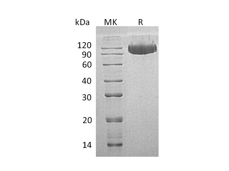 Recombinant Human Serpin G1 (C-6His)