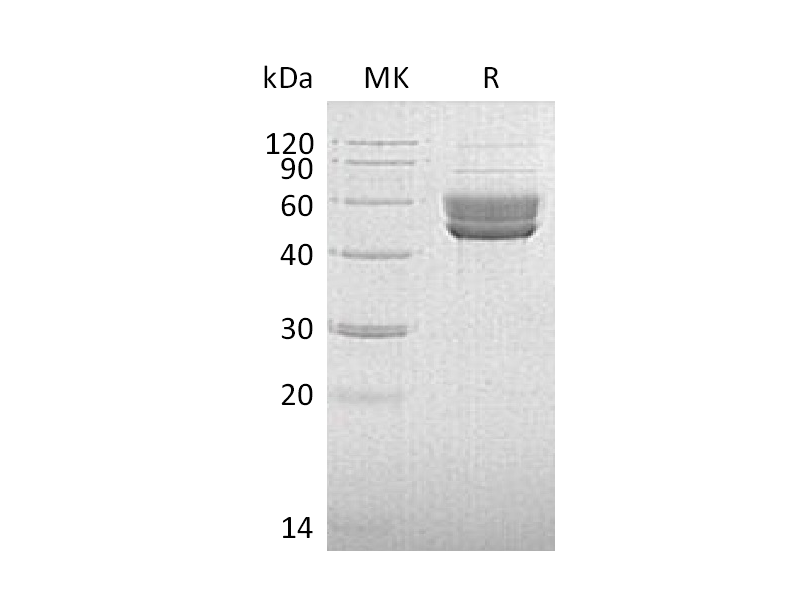 Recombinant Human Serpin I2 (C-6His)