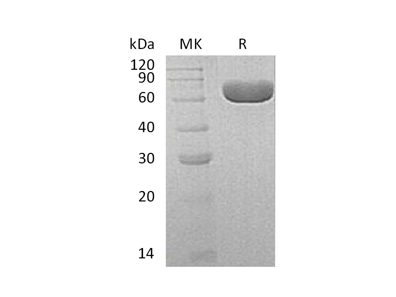 Recombinant Human SIAE (C-6His)