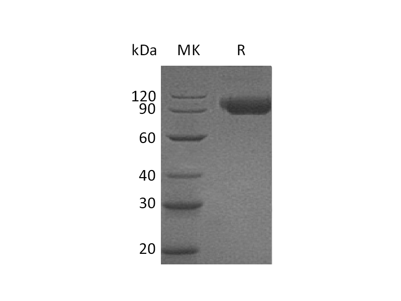 Recombinant Human Siglec-9 (C-Fc)