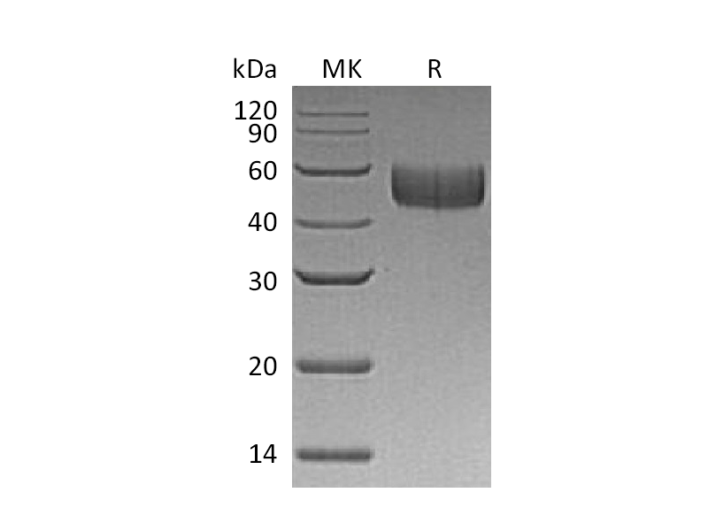Recombinant Human SIRPB1(C-6His)