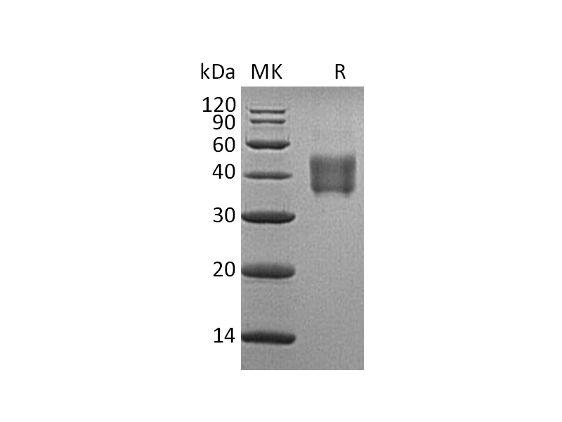 Recombinant Human SLAMF5 (C-6His)