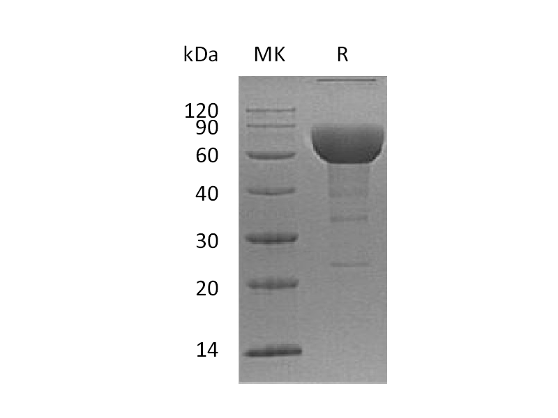 Recombinant Human SLAMF6 (C-Fc)