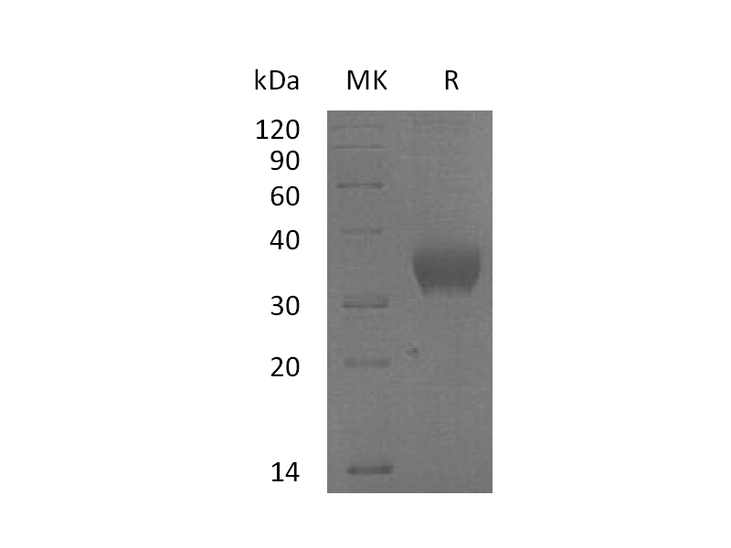 Recombinant Human SLAMF8 (C-6His)