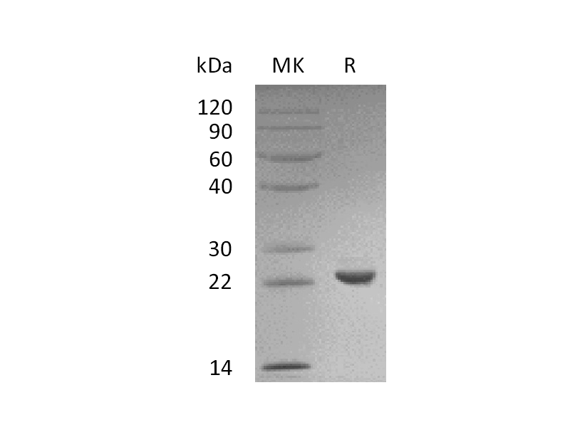 Recombinant Human SOD2 (C-6His)