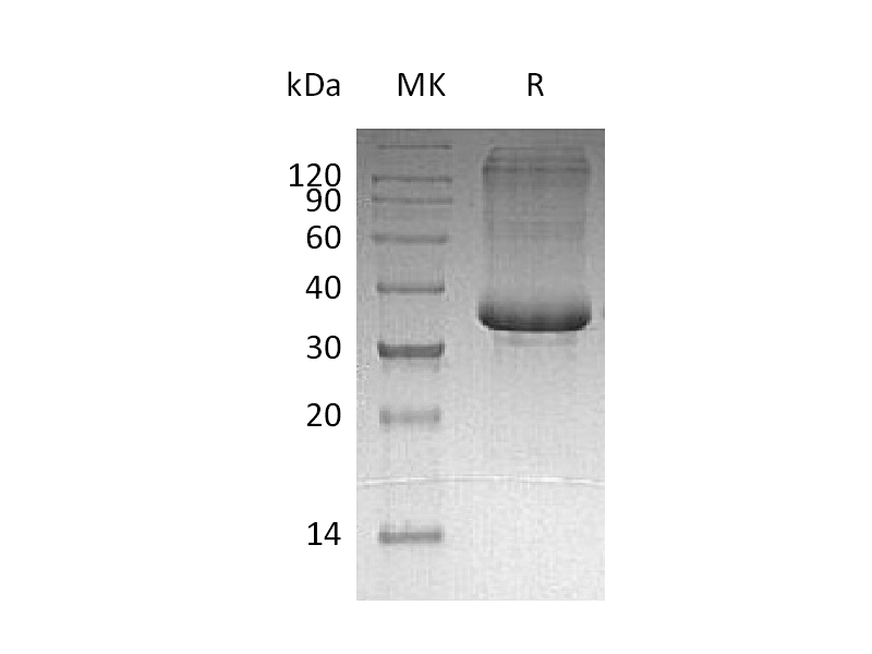 Recombinant Human SP-10 (C-6His)