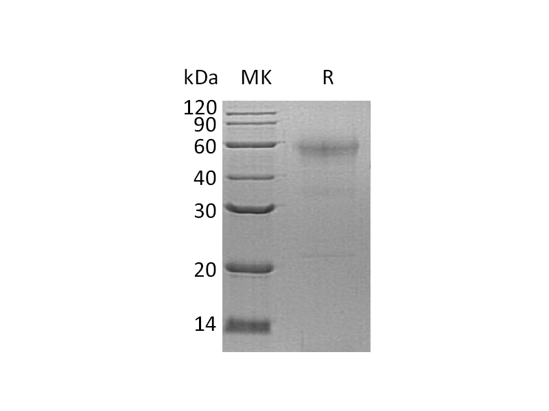 Recombinant Human SPESP1 (C-6His)