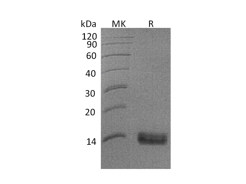 Recombinant Human SPINK1 (C-6His)