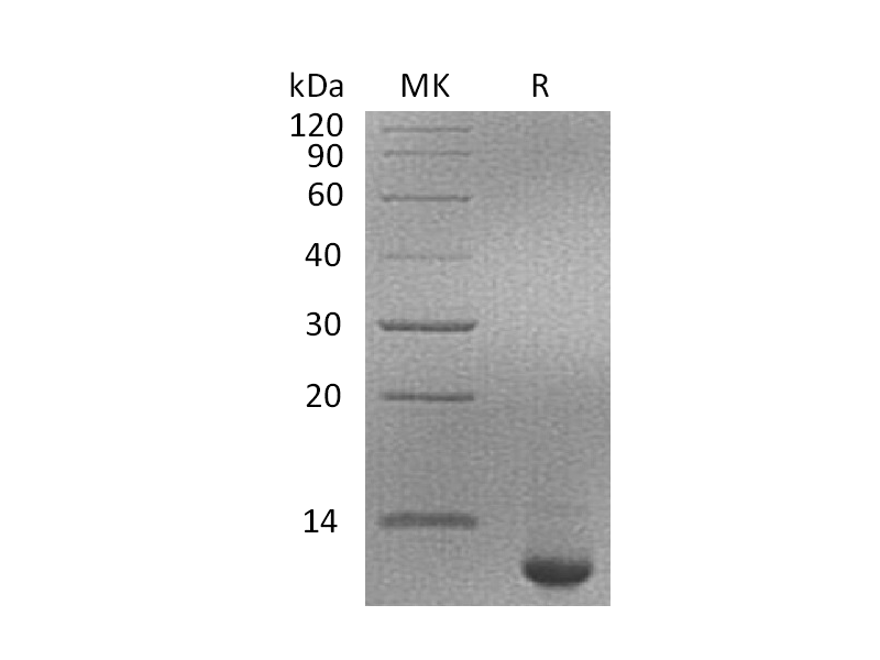 Recombinant Human SPINK4 (C-6His)
