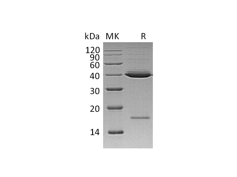 Recombinant Human Mindin (C-6His)