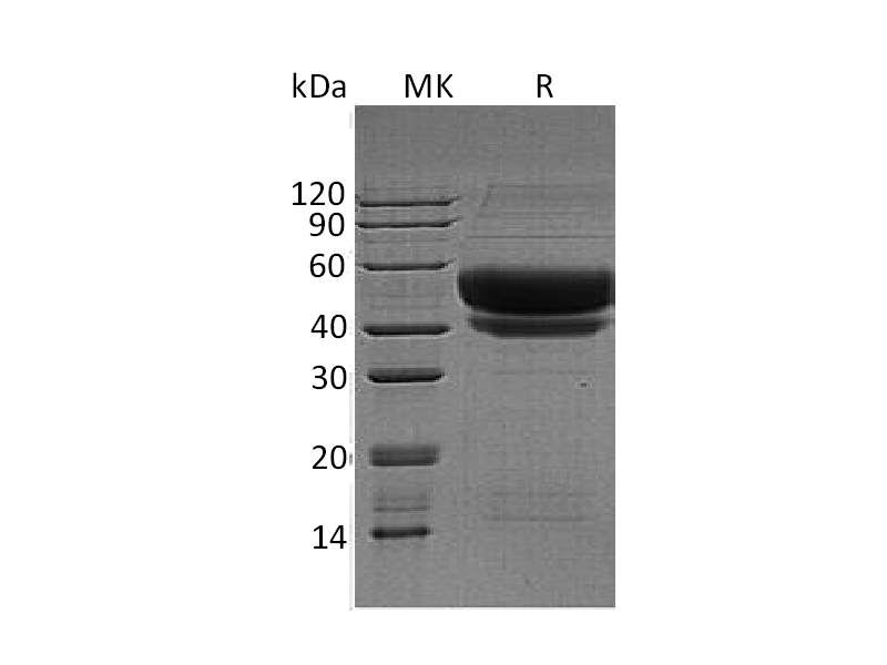 Recombinant Human ST6GAL1 (C-6His)