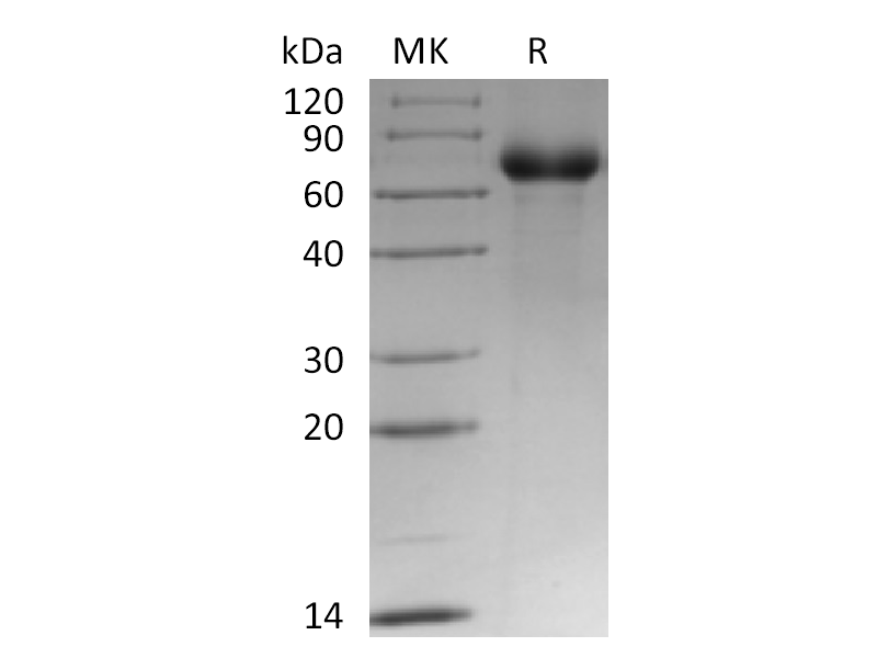 Recombinant Human LRP12 (C-6His)
