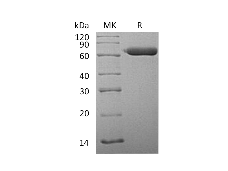 Recombinant Human SGSH (C-6His)