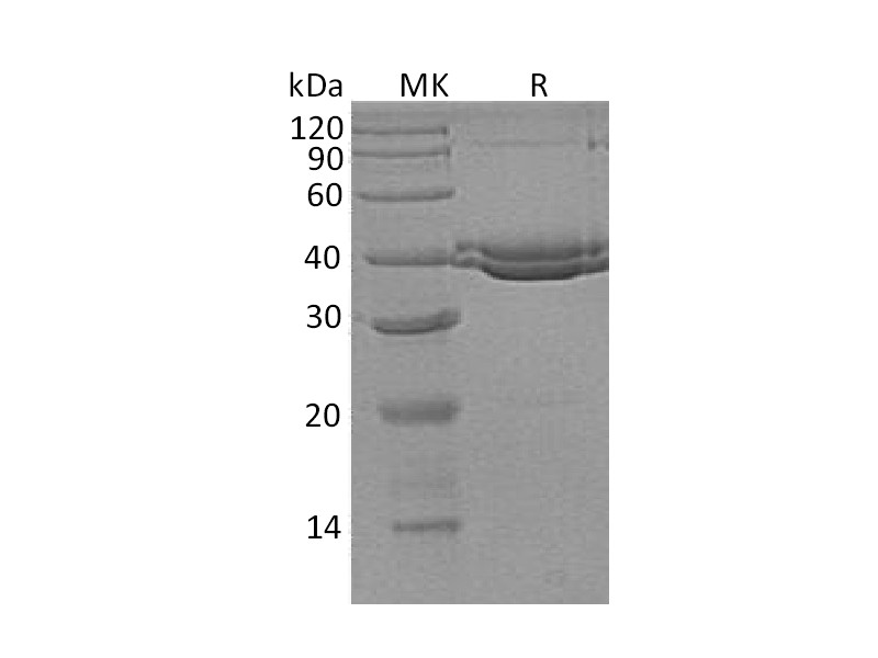 Recombinant Human SUMF1 (C-6His)