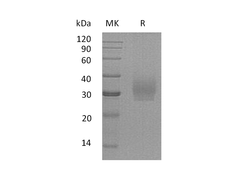 Recombinant Human SDC2 (C-6His)