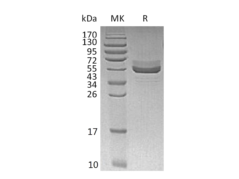 Recombinant Human TIGIT (C-Fc)