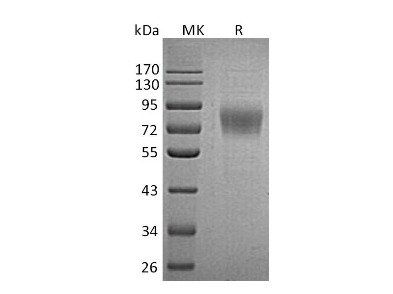 Recombinant Human PLXDC1 (C-6His)