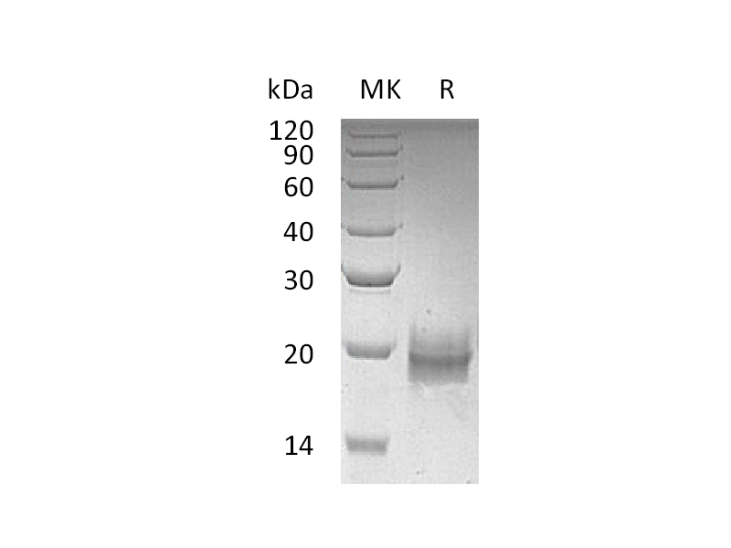Recombinant Human TFF2 (C-6His)
