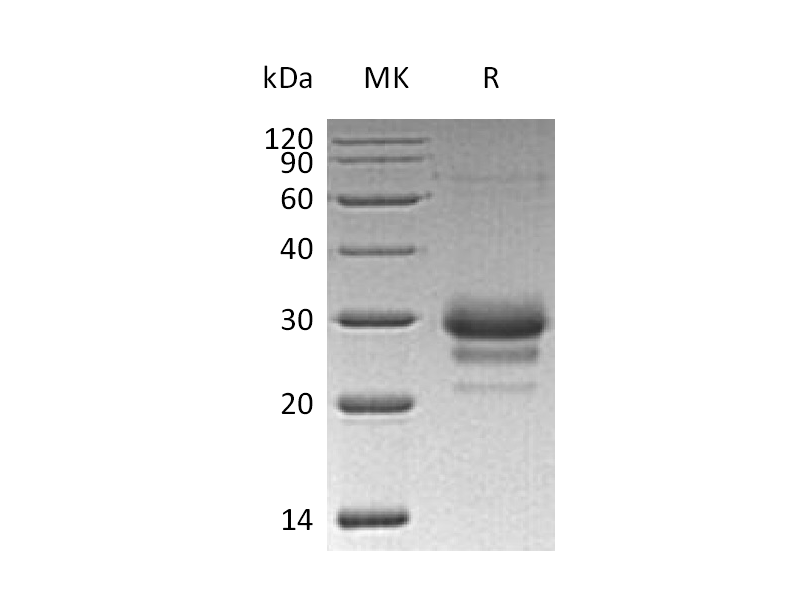 Recombinant Human TFPI-2 (C-6His)