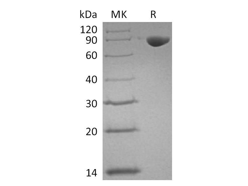 Recombinant Human TFRC (N-6His)