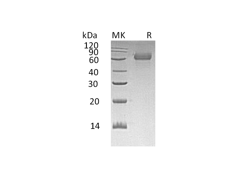 Recombinant Human TGOLN2 (C-6His)