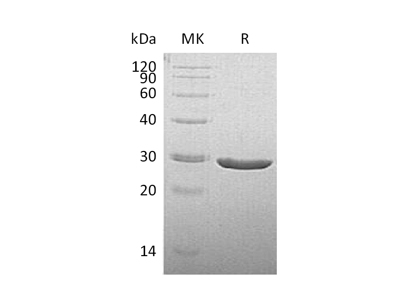 Recombinant Human TPK1 (C-6His)