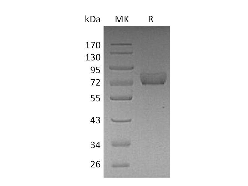 Recombinant Human Thrombomodulin (C-6His)