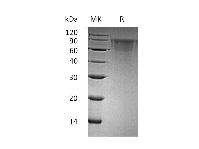 Recombinant Human THSD1 (C-6His)