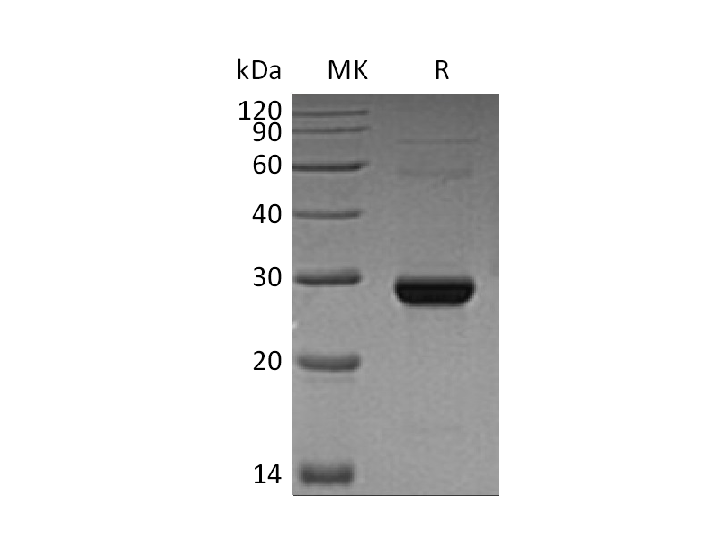 Recombinant Human TK1 (C-6His)