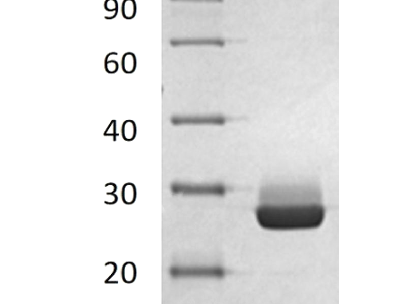 Recombinant Human DTYMK (C-6His)