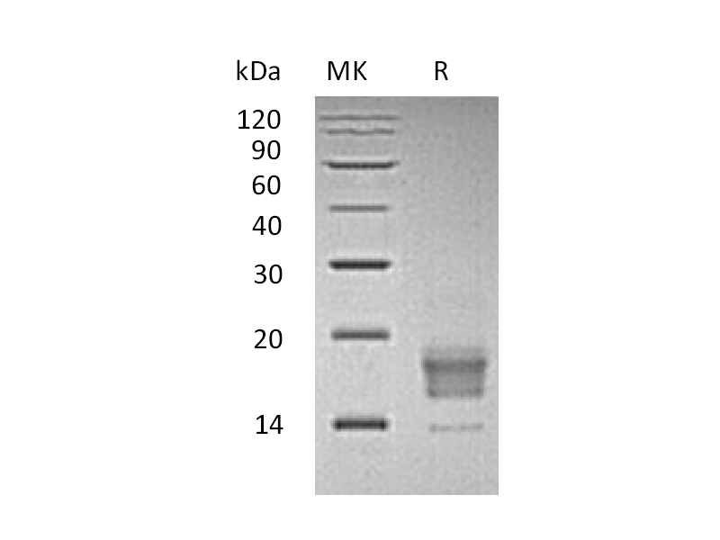 Recombinant Human TIGIT (C-6His)