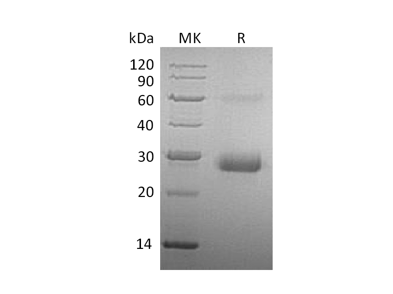 Recombinant Human TIMP-1 (C-6His)